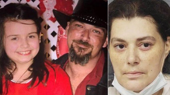 Espeluznante: una nena murió por una infestación de piojos y acusan a sus padres
