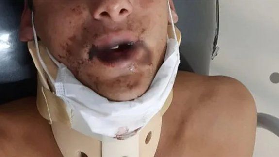 Otro salvaje ataque de rugbiers: Le pegaron en el piso