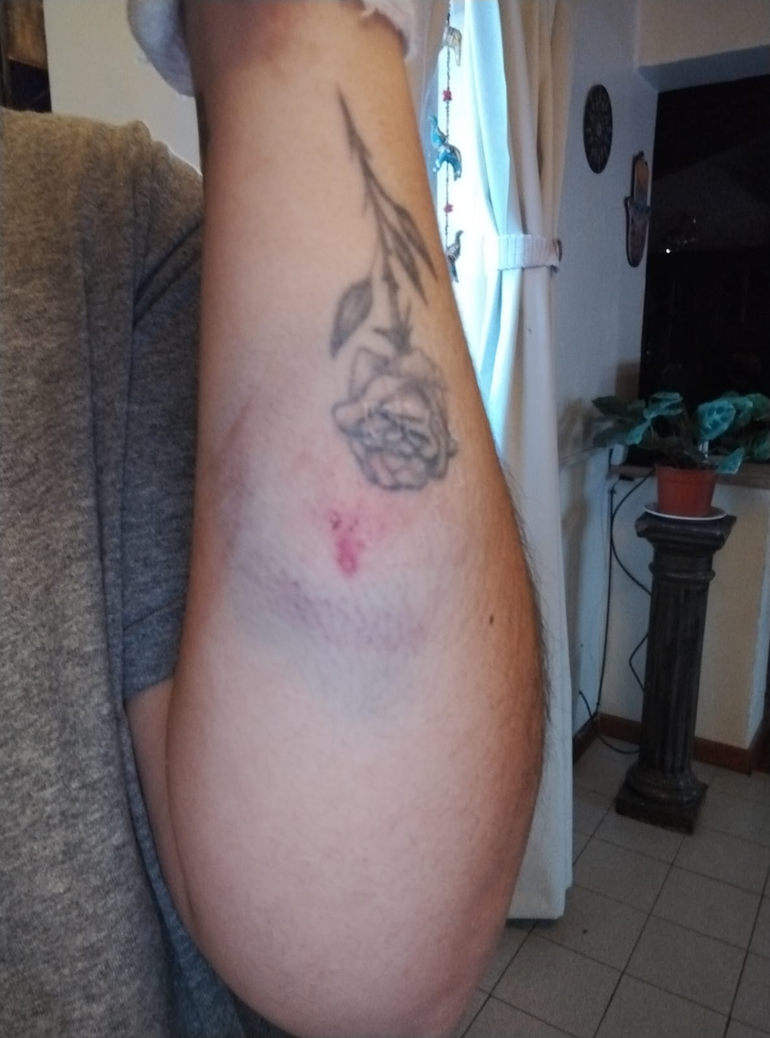 Afortunadamente, la mujer logró quitarle el cuchillo y frenar el ataque. La familia denuncia que el agresor tiene gente que Afortunadamente, la mujer logró quitarle el cuchillo y frenar el ataque. La familia denuncia que el agresor tiene gente que