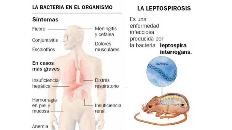 Confirman la segunda muerte en Córdoba por leptospirosis, una enfermedad que se transmite por una bacteria que suele estar presente en la orina de ciertos animales como son los roedores, perros, vacas, cerdos, caballos. Foto: Google. Confirman la segunda muerte en Córdoba por leptospirosis, una enfermedad que se transmite por una bacteria que suele estar presente en la orina de ciertos animales como son los roedores, perros, vacas, cerdos, caballos. Foto: Google.