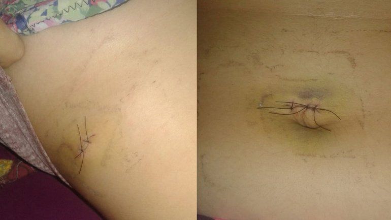 El Chañar: una joven fue apuñalada por su ex, un boxeador amateur