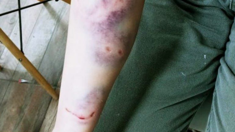 Dos pitbulls le mataron a su perra cuando salió a pasear