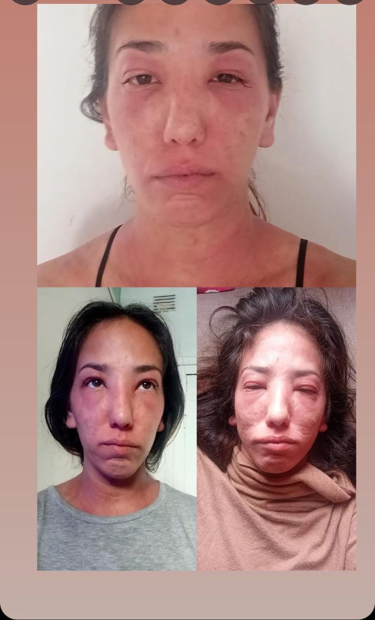 Julieta Olivera, dueña de la casa que quedó inhabitable en Sargento Cabral al 500.