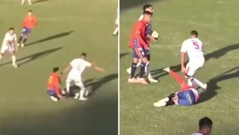 Terrible video: un jugador del ascenso sufrió una triple lesión en una rodilla y volvería a jugar en 2027