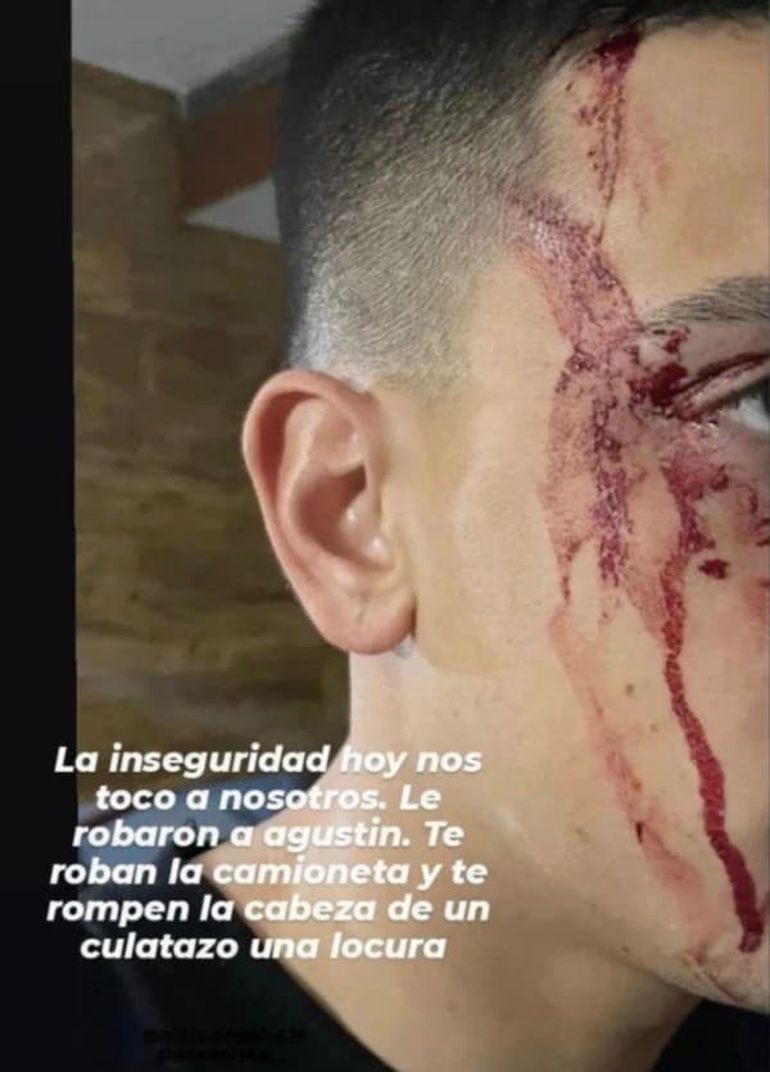 Así le quedó el rostro a Agustín Sández tras el violento asalto que sufrió luego de la derrota de Boca ante Patronato.