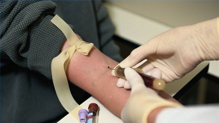 Se estima que el 30% de los afectados no sabe que es portador del virus.