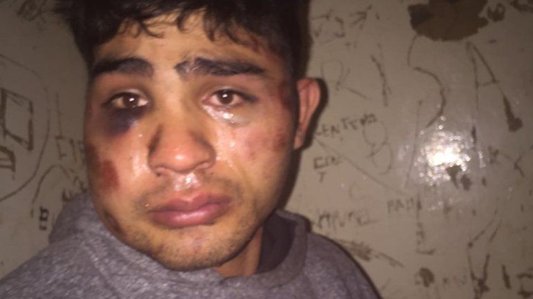 Eric Urquiza tras los golpes que recibió al ser detenido en la Comisaría 18.