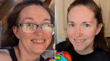 Una mujer guardó su vaporizador en el bolsillo y se le prendió fuego. Sufrió graves quemadoras en su pierna. Una mujer guardó su vaporizador en el bolsillo y se le prendió fuego. Sufrió graves quemadoras en su pierna.