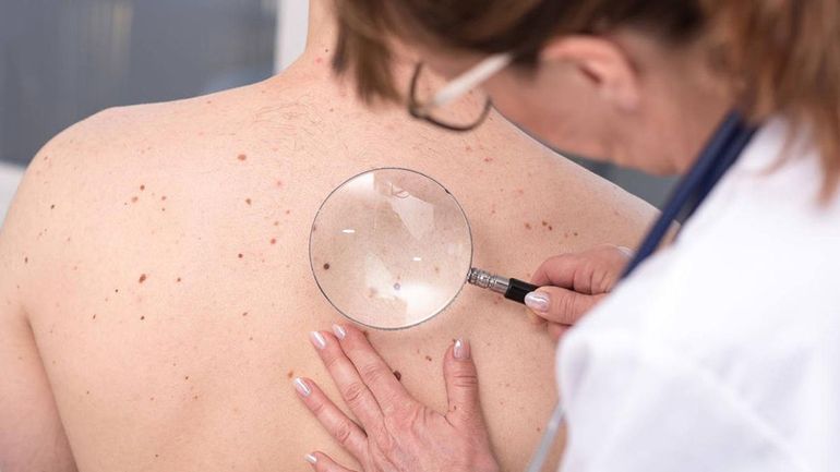 Un cambio en la piel es el signo más común de cáncer de piel, este puede ser una lesión nueva, una llaga que no cicatriza o un cambio en un lunar. Un cambio en la piel es el signo más común de cáncer de piel, este puede ser una lesión nueva, una llaga que no cicatriza o un cambio en un lunar.