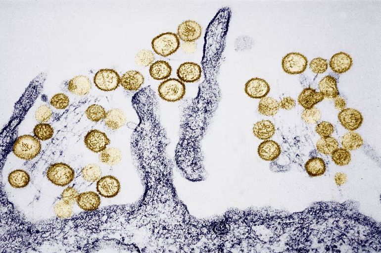 Imagen en microscopio de una muestra de hantavirus. Imagen en microscopio de una muestra de hantavirus.