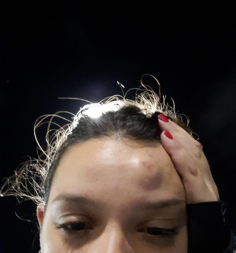 Una hincha de Racing le pegaron botellazos, tras el partido ante Talleres