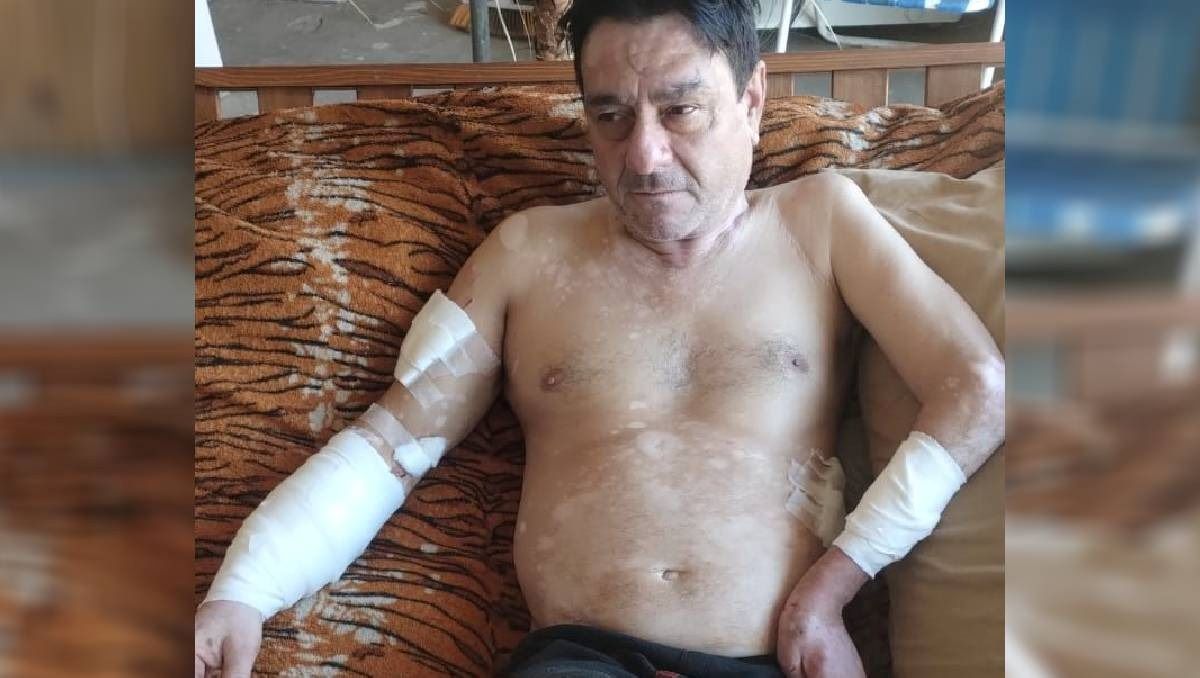 Luis García, el vecino del barrio Martín Fierro. Sufrió serias heridas por el ataque de cuatro perros.&nbsp;