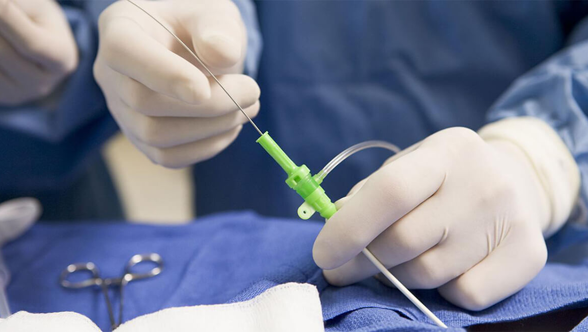 Cada dos minutos hay un cateterismo en Argentina