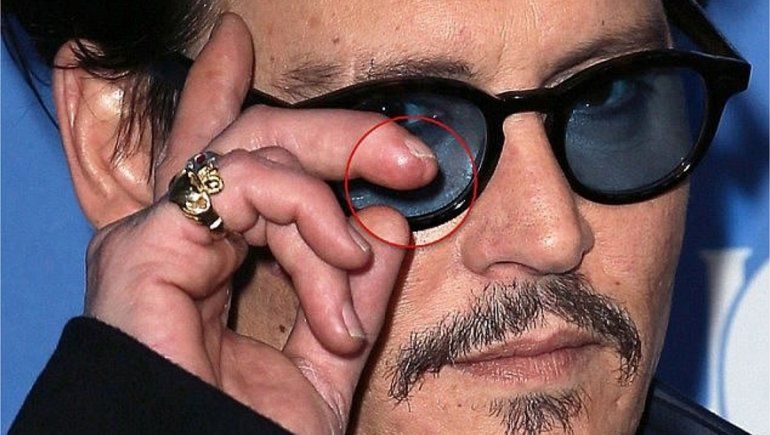 Johnny Depp perdió parte de un dedo al pelear con su ex