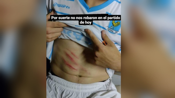 asi quedo el goleador del gallo tras brutal patada: ¡el juez saco amarilla! asi quedo el goleador del gallo tras brutal patada: ¡el juez saco amarilla!