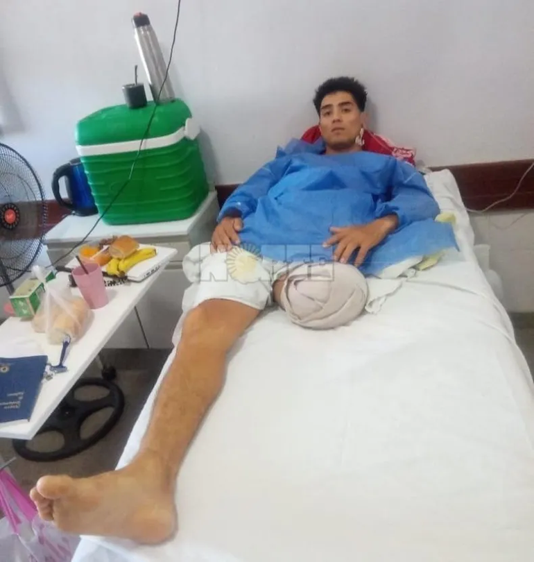 Marcelo Alegre tuvo que ser operado de urgencia y acabo con una pierna amputada después de ser baleado por su cuñado. Foto: Diario Norte Marcelo Alegre tuvo que ser operado de urgencia y acabo con una pierna amputada después de ser baleado por su cuñado. Foto: Diario Norte