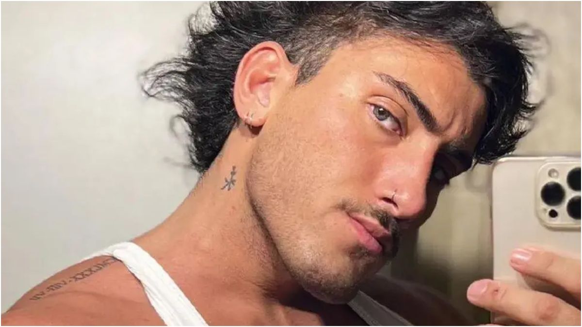 ¡Es otro! Tomás Holder se operó la cara y mostró todos los detalles