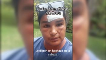La mujer sufrió golpes y un hachazo en la cabeza. La mujer sufrió golpes y un hachazo en la cabeza.
