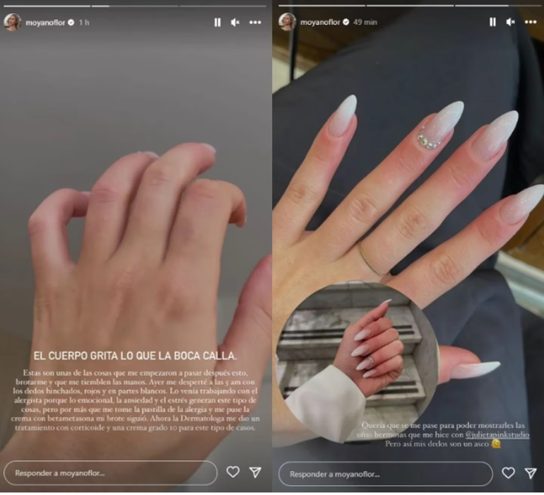 La influencer compartió en instagram las consecuencias físicas que sufre tras los abusos. “El cuerpo grita lo que la boca calla”, escribió.