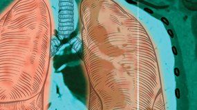 Las enfermedades neuromusculares y la respiración