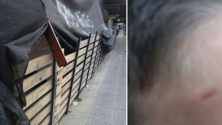 Un nene se lastimó la frente con una madera suelta en una obra céntrica