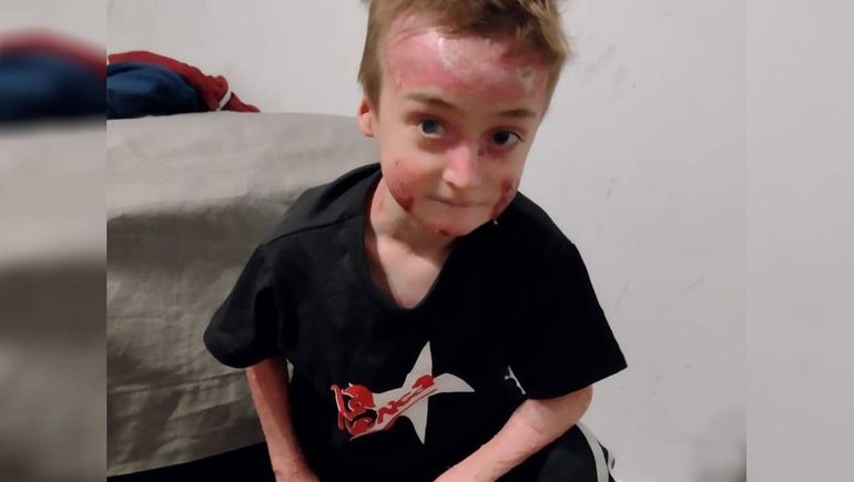 La lucha de Noah y la conmovedora solidaridad por un caso único