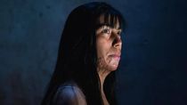 su novio la prendio fuego, la operaron 69 veces y ahora lucha por conseguir justicia su novio la prendio fuego, la operaron 69 veces y ahora lucha por conseguir justicia