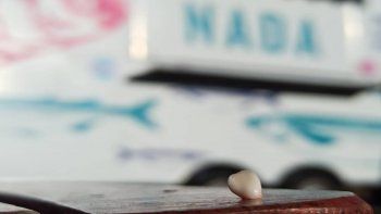 viral: encontremos a la nina y que recupere su diente de leche viral: encontremos a la nina y que recupere su diente de leche