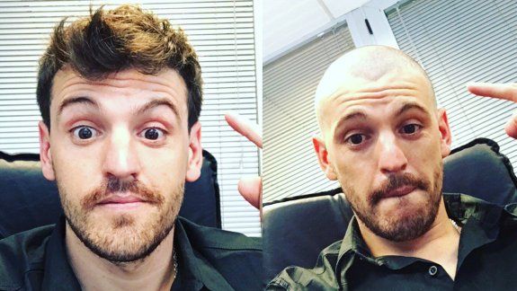 El antes y el después de Josito Di Palma, quien se peló para apoyar a Milo, el nene de dos años que tiene un tumor. También hay dedicatoria para el sobrino de Francisco Troncoso en su Torino.