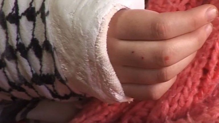 La atacaron en el aula: le quebraron 4 dedos y la obligaron a comer pasto