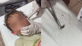 Un cangrejo entró en el oído de un niño cuando nadaba en una playa de México Un cangrejo entró en el oído de un niño cuando nadaba en una playa de México