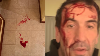 violento robo a pablo cervi: por que la justicia decidio unificar la causa con otros asaltos violento robo a pablo cervi: por que la justicia decidio unificar la causa con otros asaltos