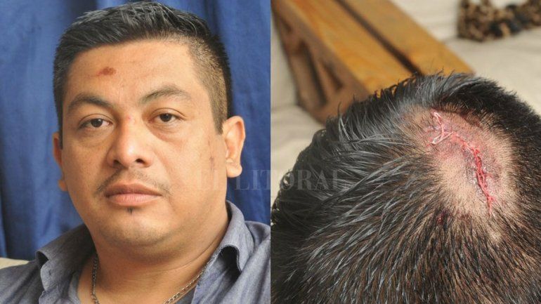 Por poco no fue tragedia. Ocurrió en el centro de la capital de Santa Fe.