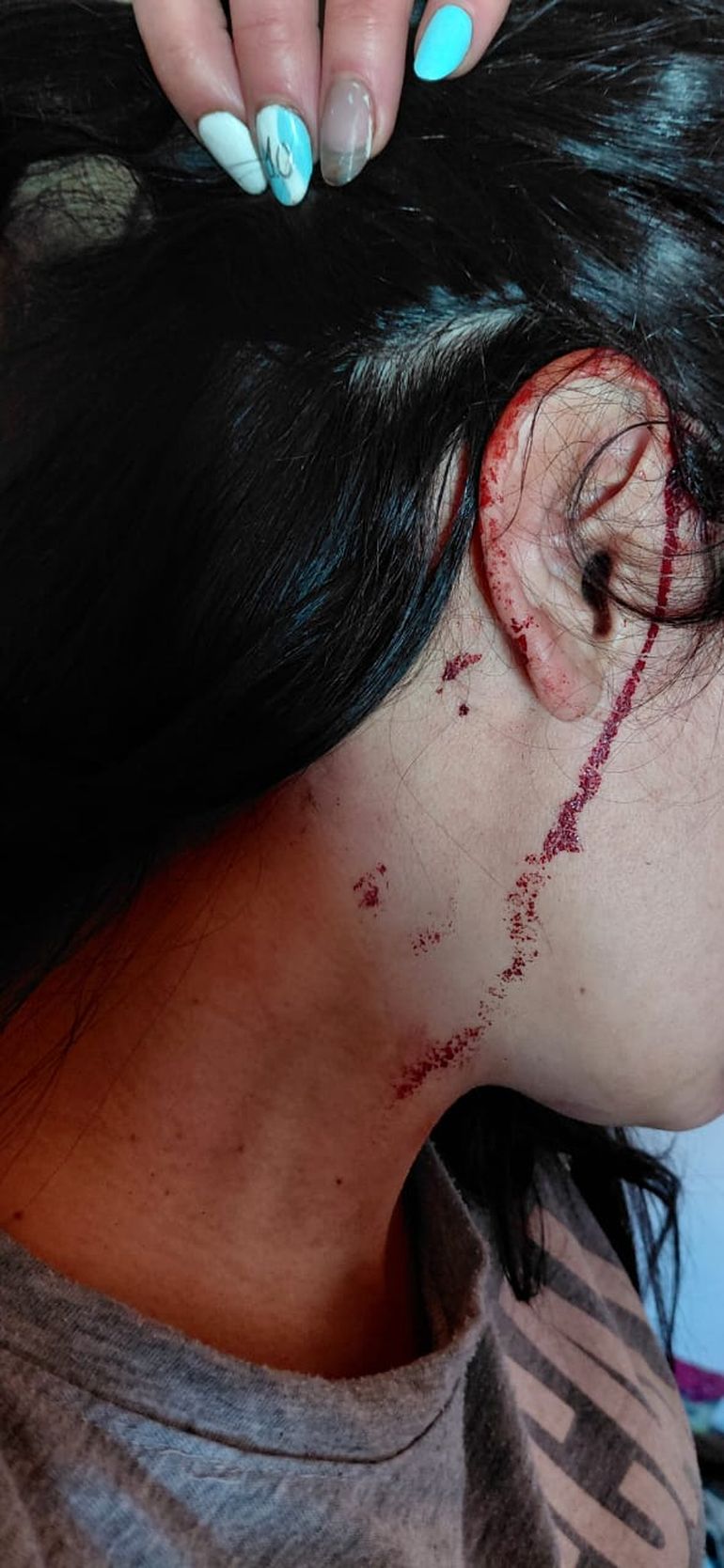 No es la primera vez que la mujer sufre una agresión a manos de su ex pareja. 