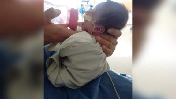 Josefina y su historia milagrosa: nació con medio kilo y sobrevivió
