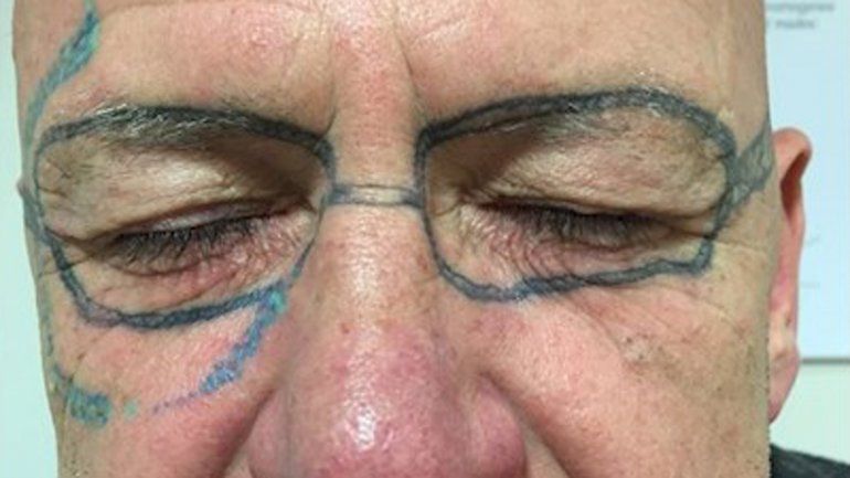 Amaneció con lentes tatuados luego de una noche loca