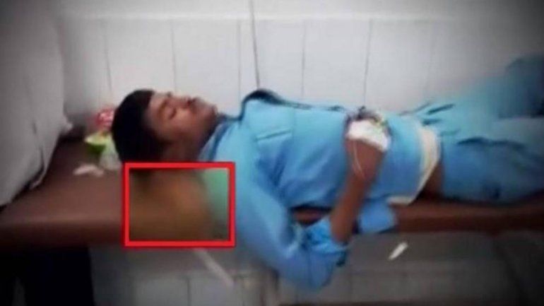 Escabroso: le pusieron la pierna amputada como almohada