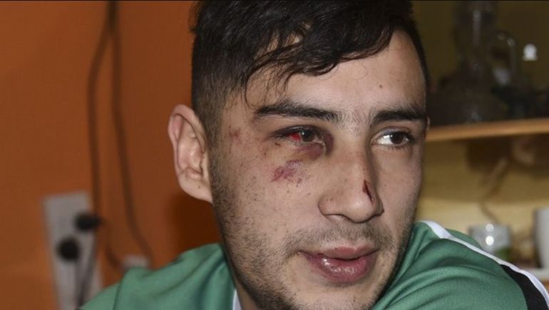 En 2016, a Matías Rima le pegaron entre cuatro policías y pasó un fin de semana internado en el hospital de Comodoro Rivadavia. En 2016, a Matías Rima le pegaron entre cuatro policías y pasó un fin de semana internado en el hospital de Comodoro Rivadavia.