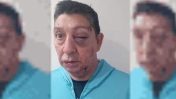 Agresión en Chubut: el árbitro Roberto de la Fuente fue salvajemente agredido en un partido en Comodoro Rivadavia. Agresión en Chubut: el árbitro Roberto de la Fuente fue salvajemente agredido en un partido en Comodoro Rivadavia.