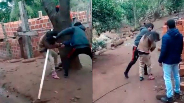 Su pareja lo dejó y le dio una brutal golpiza