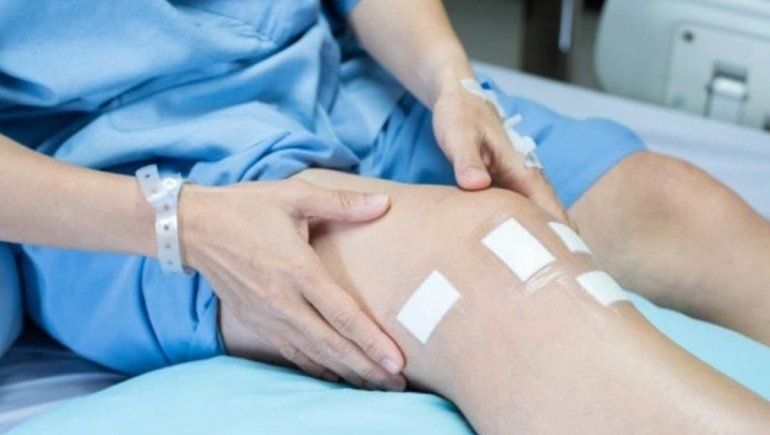 Viral: indignación en las redes porque médicos amputaron pierna equivocada a anciano. | Foto referencial.