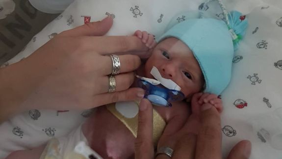Oti nació con apenas un kilo. Recibió leche humana donada durante el primer día fuerza de la panza.