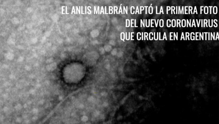 El Instituto Malbrán logró fotografiar el coronavirus nacional