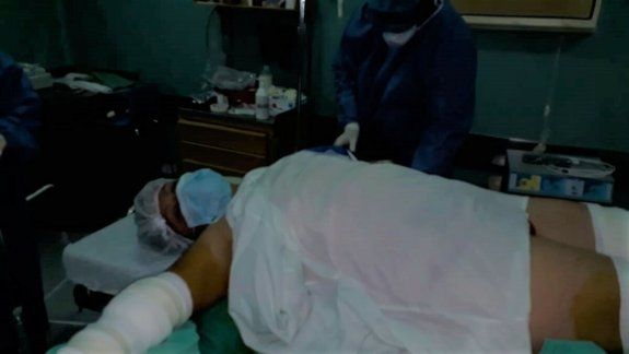 Una jauría atacó gravemente a una marinera: Me querían comer