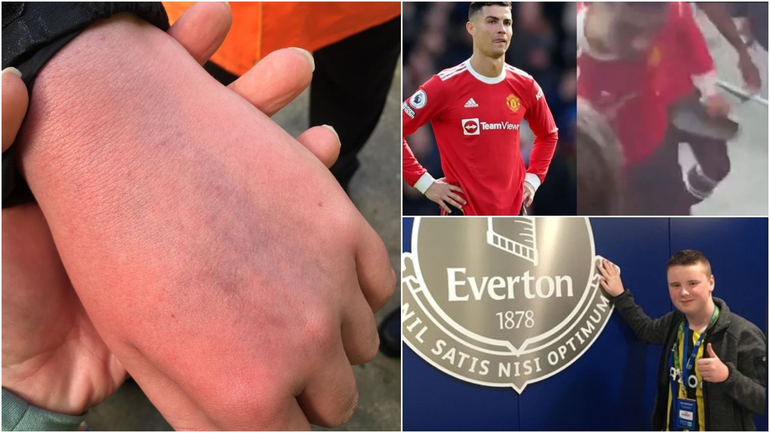 El hematoma que Ronaldo le hizo al niño que lo filmaba: el portugués pidió perdón