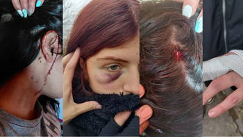 El hombre atacó brutalmente a las dos hermanas con golpes de puño, patadas y con un objeto contundente que le provocó una lesión en la cabeza.&nbsp;
