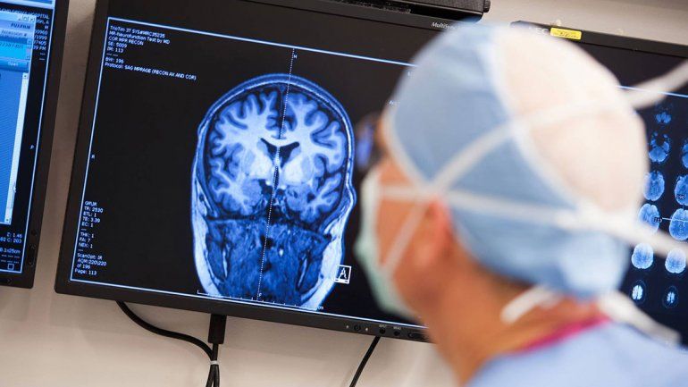 La cirugía, una opción en algunos casos de epilepsia