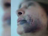 El rostro de la coordinadora de tránsito con las secuelas de la barbarie.