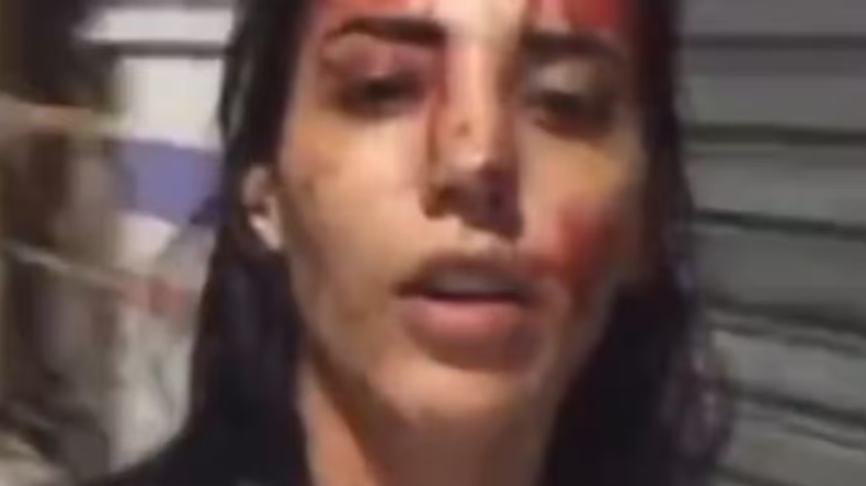 Una joven apuñaló a su pareja y se filmó ensangrentada. | LM Neuquen Una joven apuñaló a su pareja y se filmó ensangrentada.