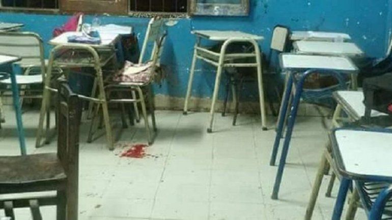 Le disparó en la cara a una compañera cuando estaban en el aula
